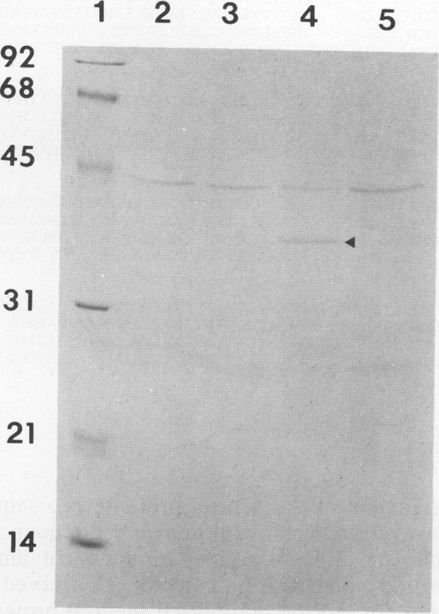 https://cdn.ncbi.nlm.nih.gov/pmc/blobs/5a63/208968/7ae69646b665/jbacter01038-0065-a.jpg