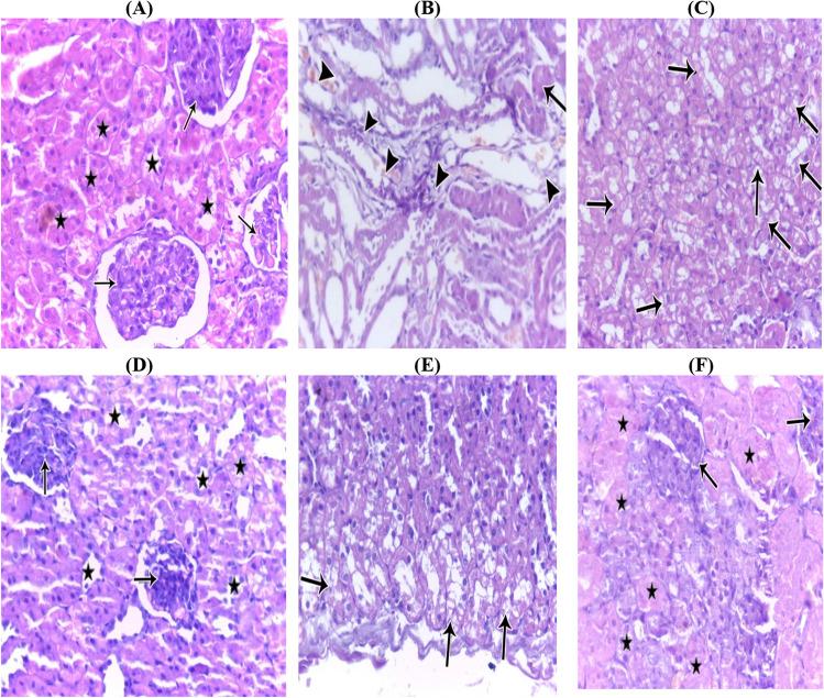 https://cdn.ncbi.nlm.nih.gov/pmc/blobs/5a64/11111484/8f934dceadc2/210_2023_2836_Fig5_HTML.jpg