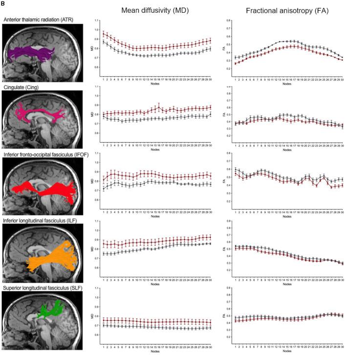 https://cdn.ncbi.nlm.nih.gov/pmc/blobs/5a68/12016576/1ceefce77b9a/fnins-19-1542957-g0006.jpg
