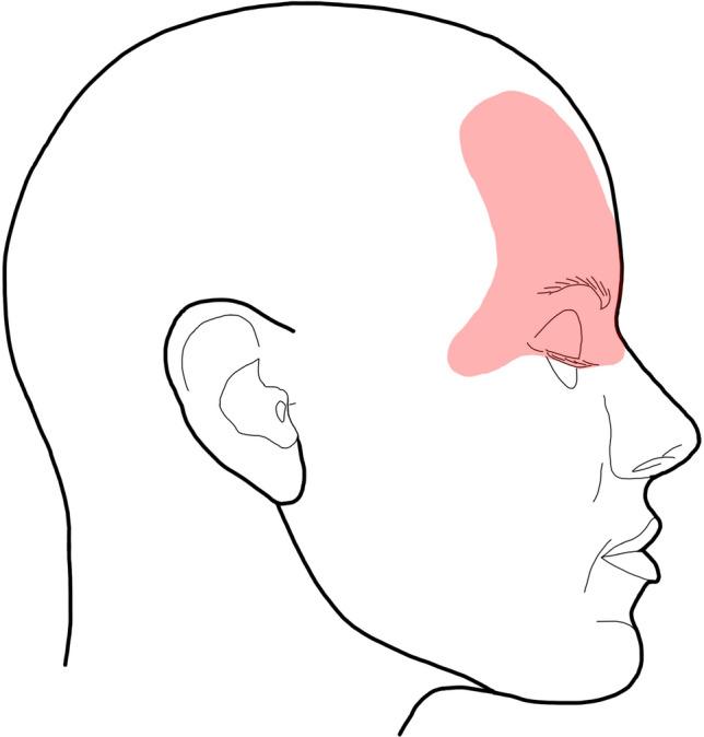 https://cdn.ncbi.nlm.nih.gov/pmc/blobs/5a6a/10390432/848cf6aa93e1/12663_2022_1838_Fig3_HTML.jpg