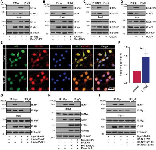 https://cdn.ncbi.nlm.nih.gov/pmc/blobs/5a6c/11831438/2ff13a84d1f4/ADVS-12-2410410-g009.jpg