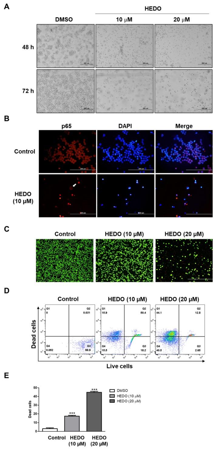 https://cdn.ncbi.nlm.nih.gov/pmc/blobs/5a6c/7072307/e015c4775abf/biomolecules-10-00324-g007.jpg
