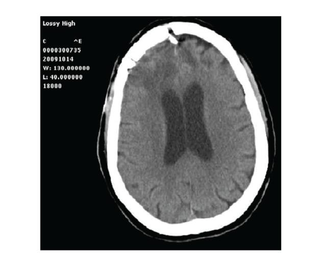 https://cdn.ncbi.nlm.nih.gov/pmc/blobs/5a6e/3423776/42848d3e948a/CRIM.SURGERY2012-614321.003.jpg