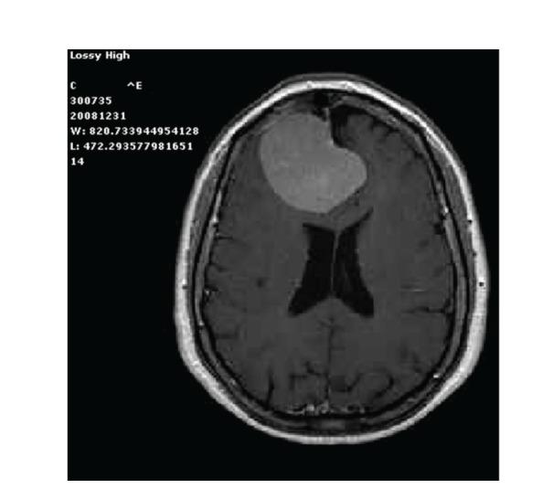 https://cdn.ncbi.nlm.nih.gov/pmc/blobs/5a6e/3423776/429246e1c5f0/CRIM.SURGERY2012-614321.001.jpg