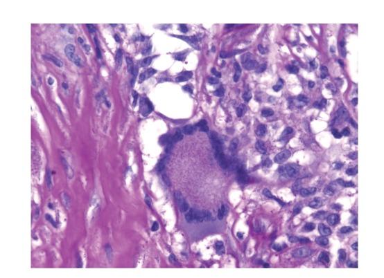 https://cdn.ncbi.nlm.nih.gov/pmc/blobs/5a6e/3423776/ad536a7f277e/CRIM.SURGERY2012-614321.006.jpg