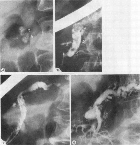 https://cdn.ncbi.nlm.nih.gov/pmc/blobs/5a73/1434395/e59d0f502c32/gut00223-0130-a.jpg