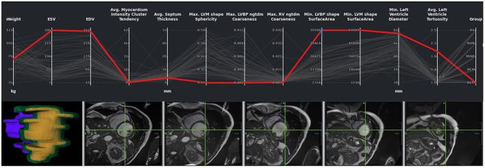 https://cdn.ncbi.nlm.nih.gov/pmc/blobs/5a7e/8960112/9efe01bba4bb/fcvm-09-829512-g0009.jpg
