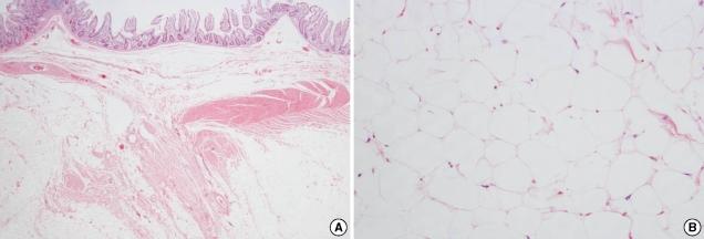 https://cdn.ncbi.nlm.nih.gov/pmc/blobs/5a86/2672139/5c9b2b5b00f8/jkms-24-333-g004.jpg