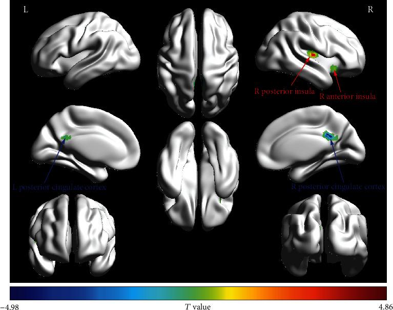 https://cdn.ncbi.nlm.nih.gov/pmc/blobs/5a87/10232109/41c130f29cef/NP2023-6560298.001.jpg