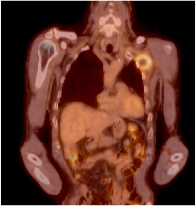 https://cdn.ncbi.nlm.nih.gov/pmc/blobs/5a88/11372864/24b40d97c542/gr3.jpg