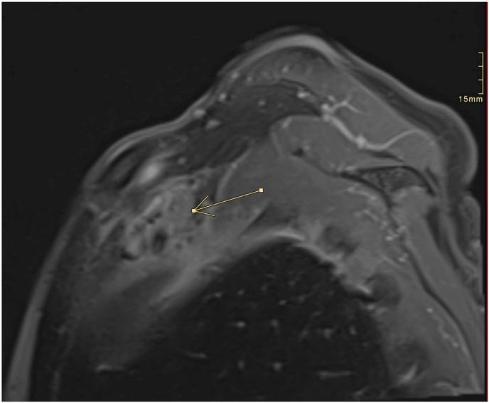 https://cdn.ncbi.nlm.nih.gov/pmc/blobs/5a88/11372864/35fe67987a00/gr2.jpg