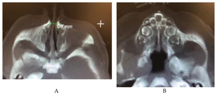 https://cdn.ncbi.nlm.nih.gov/pmc/blobs/5a88/9322467/8b63fd54de0d/children-09-00944-g009.jpg