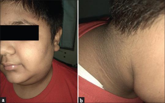 https://cdn.ncbi.nlm.nih.gov/pmc/blobs/5a89/10043648/ab70d569f832/IJD-67-645-g003.jpg