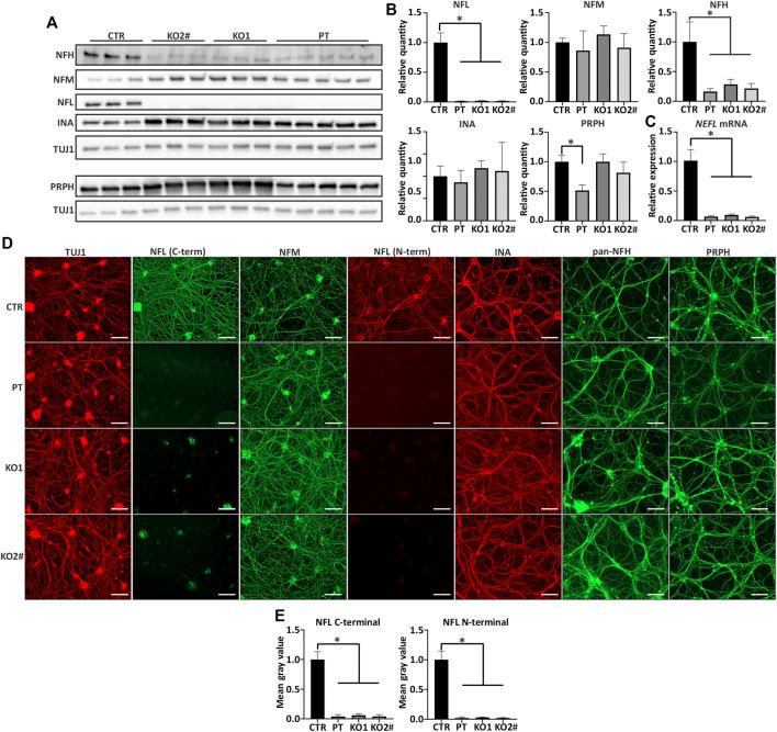 https://cdn.ncbi.nlm.nih.gov/pmc/blobs/5a8b/8883324/96948dae5534/fcell-09-820105-g002.jpg