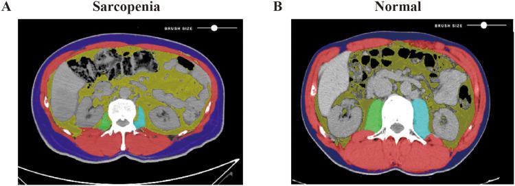 https://cdn.ncbi.nlm.nih.gov/pmc/blobs/5a8e/10822115/27867fe09843/JHC-11-175-g0002.jpg