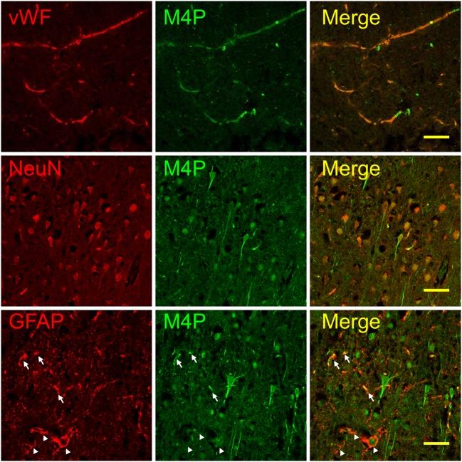 https://cdn.ncbi.nlm.nih.gov/pmc/blobs/5a8e/6892354/17d160b8562a/424_2019_2326_Fig3_HTML.jpg