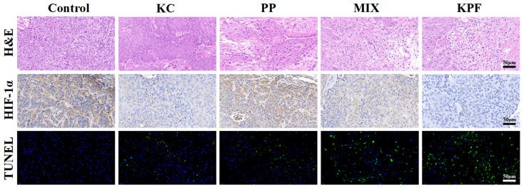 https://cdn.ncbi.nlm.nih.gov/pmc/blobs/5a96/11434982/11e5100f537c/pharmaceutics-16-01130-g006.jpg