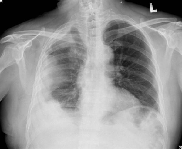 https://cdn.ncbi.nlm.nih.gov/pmc/blobs/5a96/3260116/af39acdcc10c/1746-1596-6-130-1.jpg
