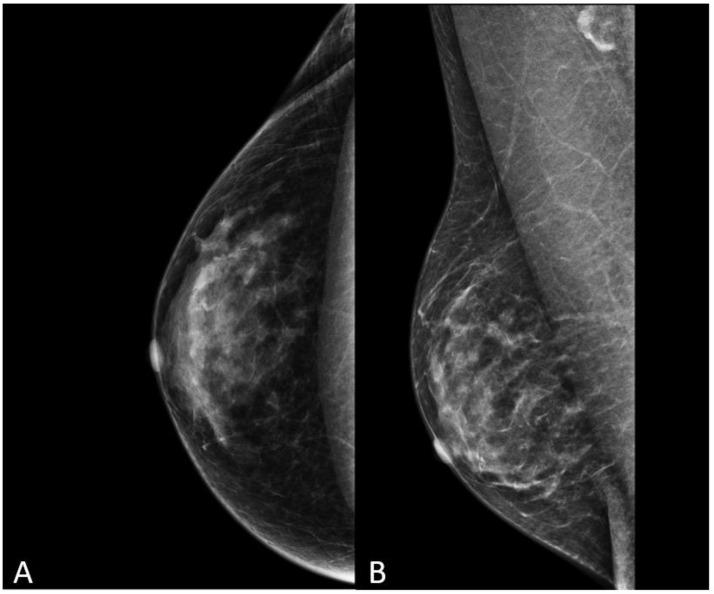 https://cdn.ncbi.nlm.nih.gov/pmc/blobs/5a98/10743117/f31b76445e97/diagnostics-13-03620-g009.jpg