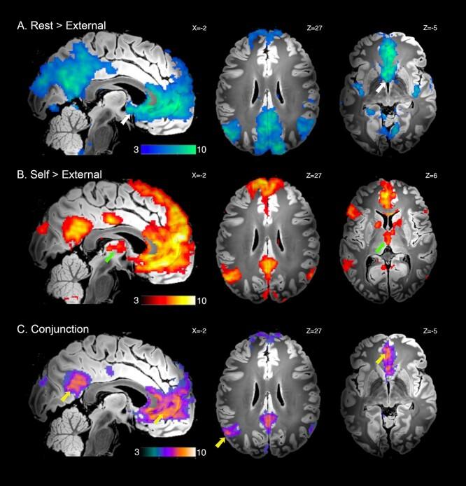 https://cdn.ncbi.nlm.nih.gov/pmc/blobs/5a9e/9528899/0931e6f1d626/bhab487f2.jpg