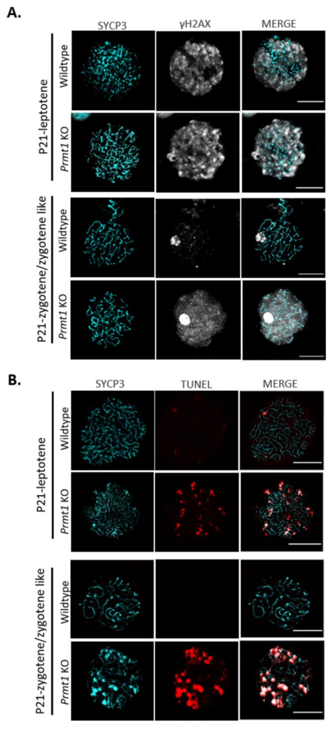 https://cdn.ncbi.nlm.nih.gov/pmc/blobs/5aa3/8348183/a57115505a22/ijms-22-07951-g005.jpg