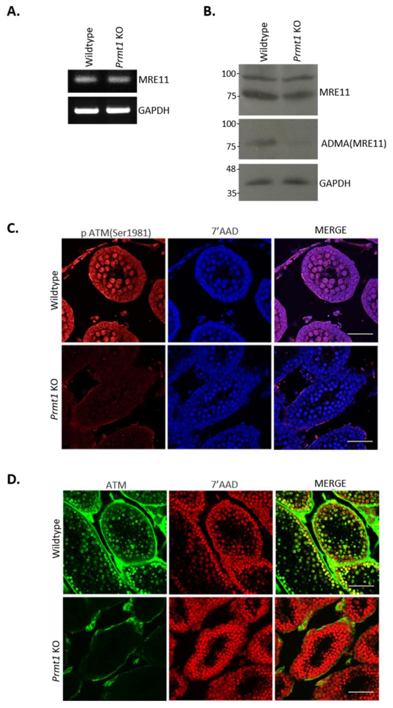 https://cdn.ncbi.nlm.nih.gov/pmc/blobs/5aa3/8348183/e690c533857b/ijms-22-07951-g006a.jpg