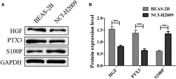 https://cdn.ncbi.nlm.nih.gov/pmc/blobs/5aa5/8567015/5658e89af23c/fonc-11-726834-g011.jpg