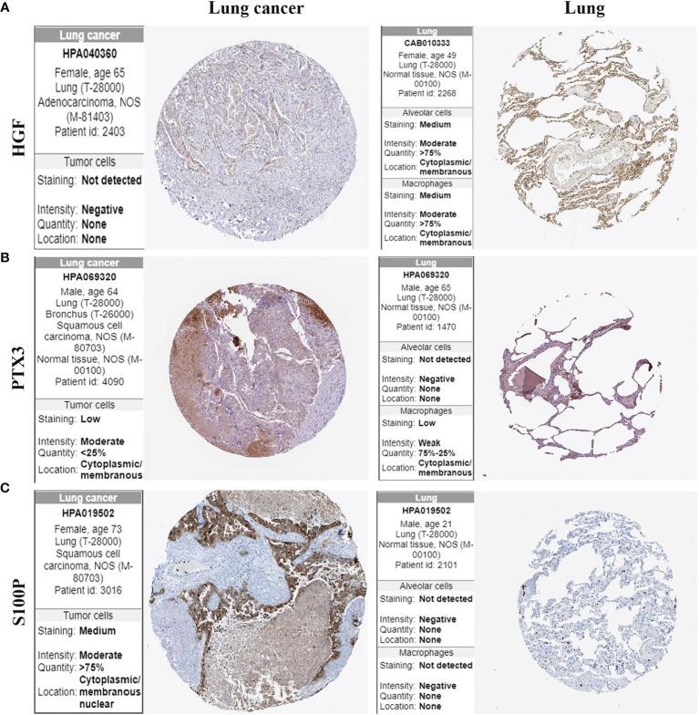https://cdn.ncbi.nlm.nih.gov/pmc/blobs/5aa5/8567015/9f161899fd2d/fonc-11-726834-g009.jpg
