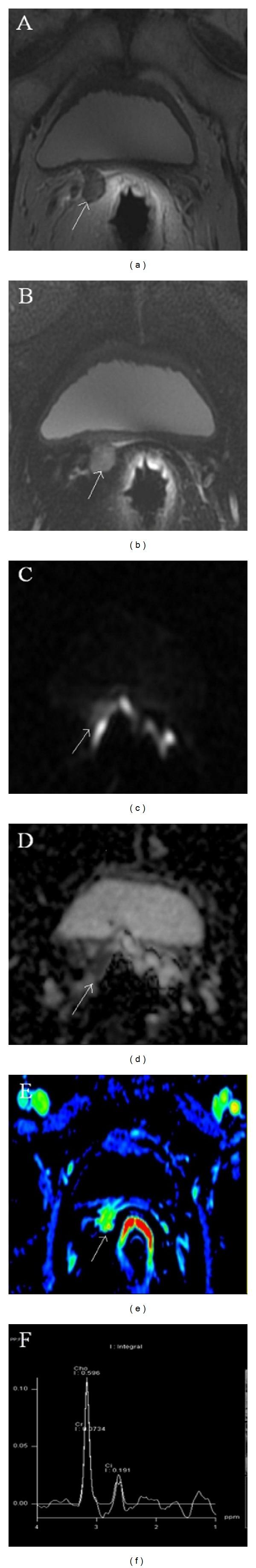 https://cdn.ncbi.nlm.nih.gov/pmc/blobs/5aac/3971570/36506f0fc1df/BMRI2014-827265.002.jpg