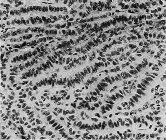 https://cdn.ncbi.nlm.nih.gov/pmc/blobs/5aad/1146004/fa65f8ca8fde/jclinpath00462-0011-b.jpg
