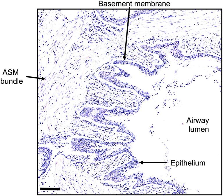 https://cdn.ncbi.nlm.nih.gov/pmc/blobs/5aad/11721269/6c93955ce324/gr1.jpg