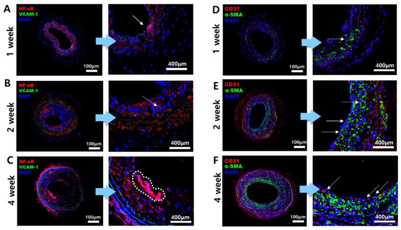 https://cdn.ncbi.nlm.nih.gov/pmc/blobs/5aaf/11432177/deb2b7d105ec/ijms-25-09877-g003.jpg