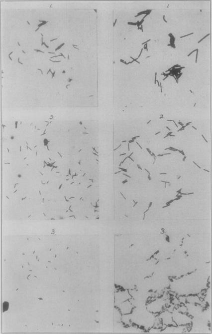 https://cdn.ncbi.nlm.nih.gov/pmc/blobs/5ab0/378828/3104d552cb63/jbacter01083-0054-a.jpg