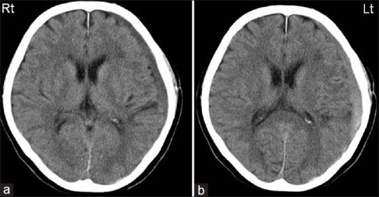 https://cdn.ncbi.nlm.nih.gov/pmc/blobs/5ac1/3766342/f2e56fd7fbb3/SNI-4-104-g006.jpg