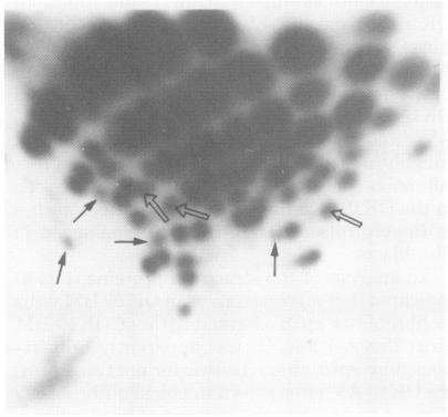 https://cdn.ncbi.nlm.nih.gov/pmc/blobs/5ac2/256656/edba24bfa6cd/jvirol00164-0214-a.jpg