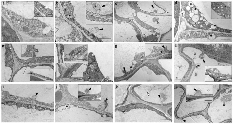 https://cdn.ncbi.nlm.nih.gov/pmc/blobs/5ac9/9861627/6d4b8afe5ddb/ijms-24-01251-g006.jpg