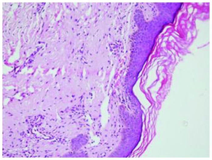 https://cdn.ncbi.nlm.nih.gov/pmc/blobs/5acb/3552729/ce1dca562e41/mjhid-5-1-e2013005f2.jpg