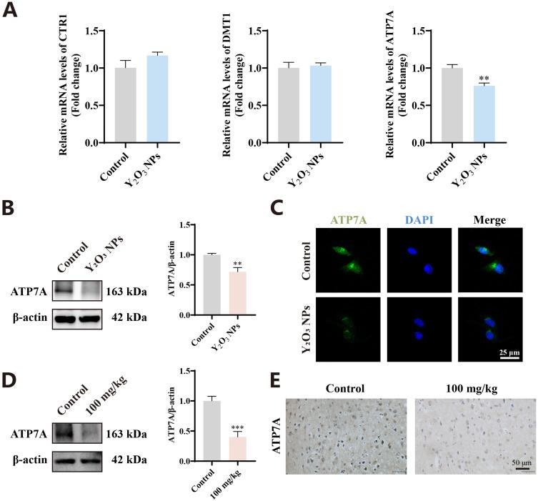 https://cdn.ncbi.nlm.nih.gov/pmc/blobs/5acf/12066367/d7c87c237ac5/IJN-20-5799-g0008.jpg