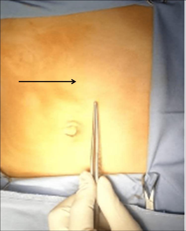 https://cdn.ncbi.nlm.nih.gov/pmc/blobs/5ad2/9654858/125ab36675d9/cureus-0014-00000030282-i01.jpg
