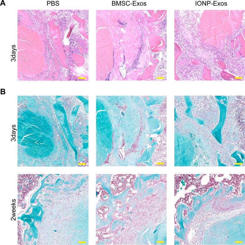 https://cdn.ncbi.nlm.nih.gov/pmc/blobs/5ad9/9218580/153af9c0d3ca/figs4.jpg