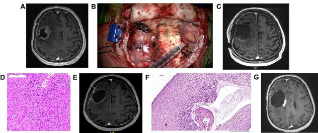 https://cdn.ncbi.nlm.nih.gov/pmc/blobs/5adb/8231061/36c80b399cc9/jitc-2020-002296f03.jpg