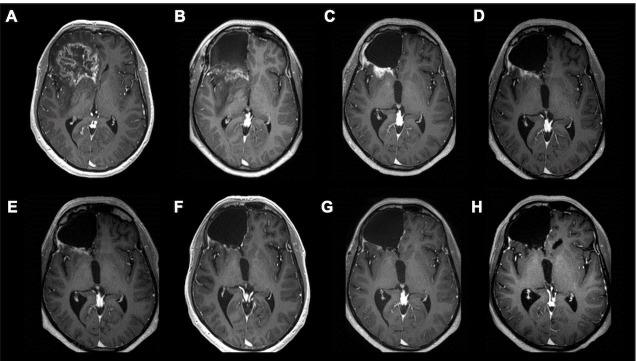 https://cdn.ncbi.nlm.nih.gov/pmc/blobs/5adb/8231061/70a14c479946/jitc-2020-002296f02.jpg
