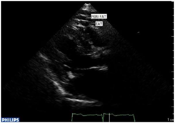 https://cdn.ncbi.nlm.nih.gov/pmc/blobs/5adc/6144498/bcd6b0d8f5cb/10.1177_2050312118799908-fig1.jpg