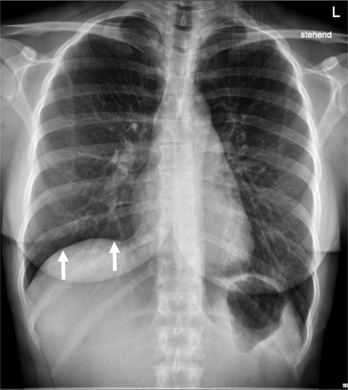 https://cdn.ncbi.nlm.nih.gov/pmc/blobs/5ae0/9250140/e8d3313afe14/gr3.jpg