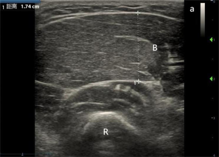 https://cdn.ncbi.nlm.nih.gov/pmc/blobs/5ae8/11796220/7b34077bac43/12877_2025_5733_Fig1_HTML.jpg