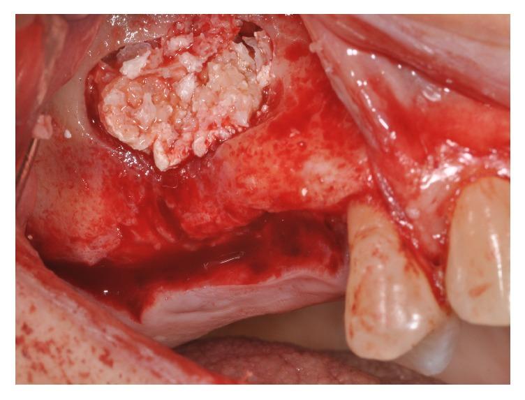 https://cdn.ncbi.nlm.nih.gov/pmc/blobs/5aeb/5352871/d10c0917f33a/BMRI2017-2594670.003.jpg