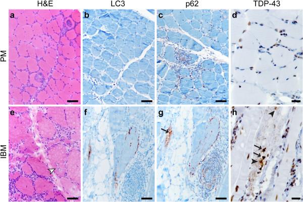 https://cdn.ncbi.nlm.nih.gov/pmc/blobs/5aed/3893502/356cd282566a/2051-5960-1-29-1.jpg
