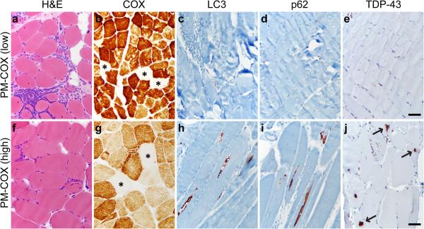 https://cdn.ncbi.nlm.nih.gov/pmc/blobs/5aed/3893502/b80a91a03c93/2051-5960-1-29-3.jpg