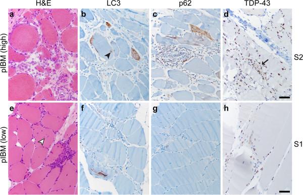 https://cdn.ncbi.nlm.nih.gov/pmc/blobs/5aed/3893502/d00dbc7d0f4b/2051-5960-1-29-5.jpg
