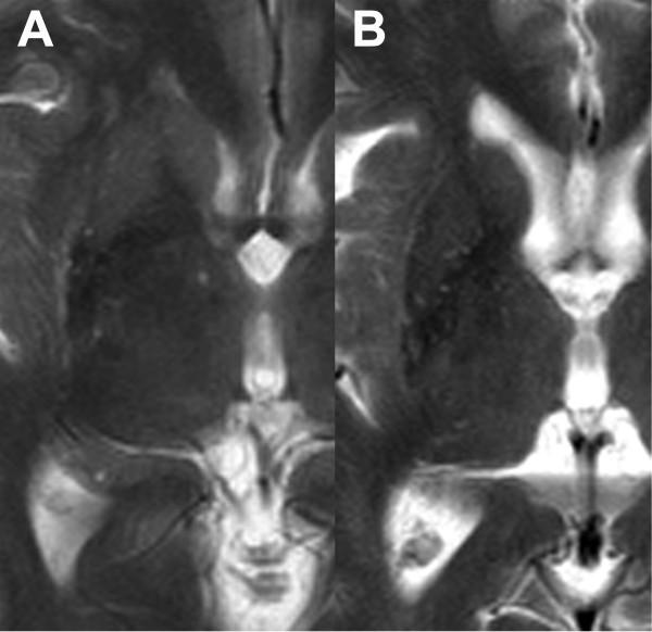 https://cdn.ncbi.nlm.nih.gov/pmc/blobs/5aef/3460737/b5b6571496aa/1471-2377-12-39-4.jpg